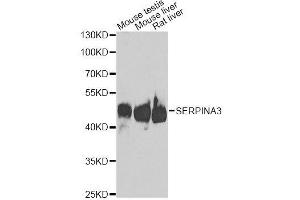 Western blot analysis of extracts of various cell lines, using SERPINA3 antibody. (SERPINA3 抗体  (AA 24-423))