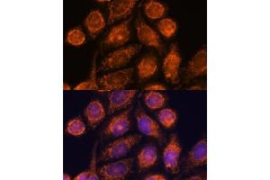 Immunofluorescence analysis of HeLa cells using MTMR9 antibody (ABIN6128253, ABIN6144163, ABIN6144164 and ABIN6217000) at dilution of 1:100. (MTMR9 抗体  (AA 1-250))