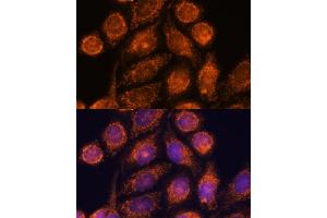 Immunofluorescence analysis of HeLa cells using MTMR9 antibody (ABIN6128253, ABIN6144163, ABIN6144164 and ABIN6217000) at dilution of 1:100. (MTMR9 抗体  (AA 1-250))