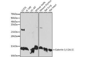 Western blot analysis of extracts of various cell lines, using Galectin 1/LG Rabbit mAb (ABIN7268197) at 1:1000 dilution. (LGALS1/Galectin 1 抗体)