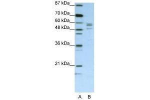 SARS antibody used at 1. (Seryl-tRNA Synthetase (SARS) (C-Term) 抗体)