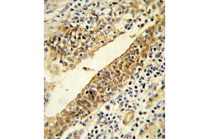 Immunohistochemistry (Paraffin-embedded Sections) (IHC (p)) image for anti-Cytochrome P450, Family 51, Subfamily A, Polypeptide 1 (CYP51A1) (AA 250-279) antibody (ABIN652820)