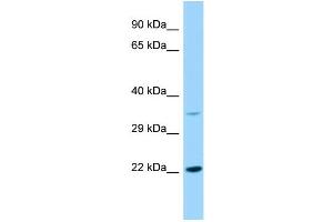 Host: Rabbit Target Name: KDELR2 Sample Type: RPMI-8226 Whole Cell lysates Antibody Dilution: 1. (KDELR2 抗体  (Middle Region))