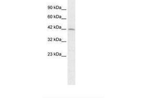 Image no. 1 for anti-Paired Box 3 (PAX3) (AA 164-213) antibody (ABIN202433) (Paired Box 3 抗体  (AA 164-213))