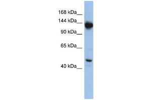 NRD1 antibody used at 1 ug/ml to detect target protein. (NRD1 抗体)