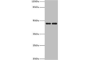 Western blot All lanes: Paired box protein Pax-6 antibody at 1 μg/mL Lane 1: Mouse stomach tissue Lane 2: Mouse eye tissue Secondary Goat polyclonal to rabbit IgG at 1/10000 dilution Predicted band size: 47, 49 kDa Observed band size: 47 kDa (PAX6 抗体  (AA 1-300))