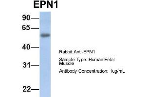 Host: Rabbit Target Name: EPN1 Sample Type: Human Fetal Muscle Antibody Dilution: 1. (Epsin 1 抗体  (C-Term))