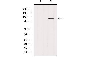 Western Blotting (WB) image for anti-Signal Transducer and Activator of Transcription 3 (Acute-Phase Response Factor) (STAT3) (C-Term) antibody (ABIN6265317)