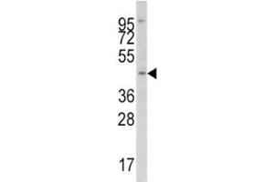 Western blot analysis of IRF8 antibody and Jurkat lysate. (IRF8 抗体  (AA 241-269))