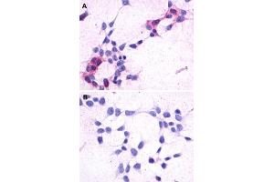 Immunocytochemistry (ICC) staining of HEK293 human embryonic kidney cells transfected (A) or untransfected (B) with GPR44. (Prostaglandin D2 Receptor 2 (PTGDR2) (3rd Extracellular Domain) 抗体)