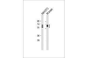 All lanes : Anti-DRP-2 Antibody at 1:8000 dilution Lane 1: NIH/3T3 whole cell lysate Lane 2: Mouse brain lysate Lysates/proteins at 20 μg per lane. (DRP2 抗体  (AA 463-492))