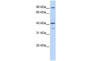 OAS1 antibody used at 0. (OAS1 抗体  (Middle Region))