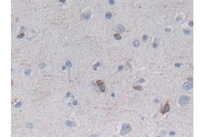 Immunohistochemistry (IHC) image for anti-Heat Shock 27kDa Protein Family, Member 7 (Cardiovascular) (HSPB7) (AA 1-170) antibody (ABIN7441055)