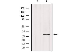 Western blot analysis of extracts from mouse brain, using CA7 Antibody. (CA7 抗体  (C-Term))