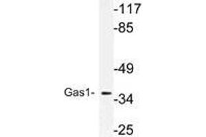 Western blot (WB) analysis of Gas1 antibody in extracts from MCF-7 cells. (GAS1 抗体)