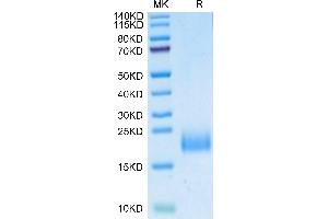 Human uPAR Domain 1 on Tris-Bis PAGE under reduced condition.