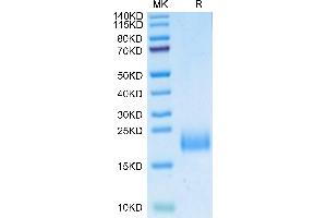 Human uPAR Domain 1 on Tris-Bis PAGE under reduced condition. (PLAUR Protein (AA 23-114) (His tag))