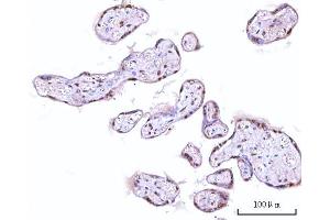 IHC analysis of RNGTT using anti-RNGTT antibody (ABIN7599723).