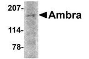 Western blot analysis of Ambra1 in rat brain tissue lysate with AP30048PU-N Ambra1 antibody at 2 μg/ml. (AMBRA1 抗体  (N-Term))