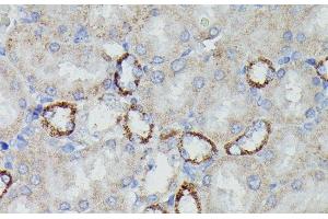Immunohistochemistry of paraffin-embedded Rat kidney using NDUFAB1 Polyclonal Antibody at dilution of 1:100 (40x lens). (NDUFAB1 抗体)