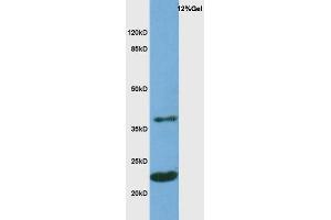 Mouse brain probed with Rabbit Anti-MOG Polyclonal Antibody, Unconjugated  at 1:3000 for 90 min at 37˚C. (MOG 抗体  (AA 35-55))