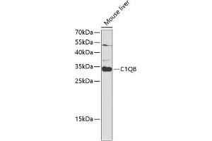 Western blot analysis of extracts of mouse liver, using C1QB antibody (ABIN6131395, ABIN6137754, ABIN6137756 and ABIN6220972) at 1:1000 dilution. (C1QB 抗体  (AA 104-253))