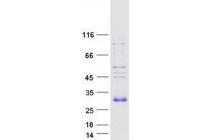 Validation with Western Blot