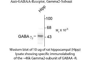 Western Blotting (WB) image for anti-gamma-aminobutyric Acid (GABA) A Receptor, gamma 2 (GABRG2) (Cytoplasmic Loop) antibody (ABIN6658227)