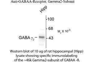Western blot of GABAA Receptor γ2 Antibody Western Blot of Rabbit anti-GABAA Receptor γ2 Antibody.