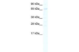 WB Suggested Anti-STAT1 Antibody Titration:  5. (STAT1 抗体  (N-Term))