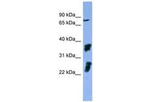 Image no. 1 for anti-Fibroblast Growth Factor Receptor 2 (FGFR2) (AA 508-557) antibody (ABIN6746746) (FGFR2 抗体  (AA 508-557))