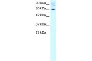 Western Blotting (WB) image for anti-Forkhead Box J2 (FOXJ2) antibody (ABIN2460611) (Forkhead Box J2 抗体)