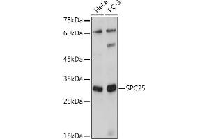 Western blot analysis of extracts of various cell lines, using SPC25 antibody (ABIN7270515) at 1:1000 dilution. (SPC25 抗体  (AA 1-224))