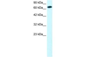 Western Blotting (WB) image for anti-Signal Transducer and Activator of Transcription 4 (STAT4) antibody (ABIN2460707) (STAT4 抗体)