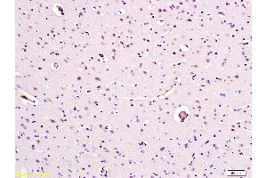 Paraformaldehyde-fixed, paraffin embedded Human Brain Antigen retrieval by boiling in sodium citrate buffer (pH6. (Caspase 9 抗体  (AA 271-314))