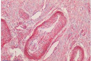 (ABIN185421) (2. (Caveolin-1 抗体  (Internal Region))