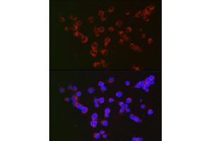 Immunofluorescence analysis of Neuro-2a cells using α-Synuclein Rabbit mAb (ABIN7270695) at dilution of 1:100 (40x lens). (SNCA 抗体  (AA 59-140))