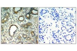 Immunohistochemistry (IHC) image for anti-Protein tyrosine Phosphatase, Non-Receptor Type 11 (PTPN11) (pTyr580) antibody (ABIN7139030)