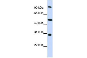 EML1 antibody used at 1 ug/ml to detect target protein. (EML1 抗体  (C-Term))