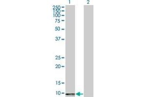 Western Blot analysis of ERAF expression in transfected 293T cell line by ERAF polyclonal antibody (A01). (aHSP 抗体  (AA 1-102))