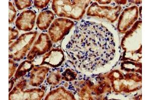 Immunohistochemistry of paraffin-embedded human kidney tissue using ABIN7156331 at dilution of 1:100 (Insulin Receptor 抗体  (AA 1023-1298))
