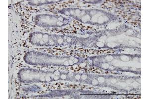 Immunostaining (ISt) image for anti-MAP Kinase Interacting serine/threonine Kinase 1 (MKNK1) (AA 1-465) antibody (ABIN522034)