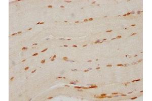 IHC image of ABIN7127502 diluted at 1:70 and staining in paraffin-embedded human skeletal muscle tissue performed on a Leica BondTM system. (Recombinant FTO 抗体)