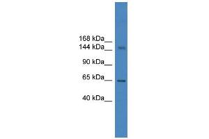 WB Suggested Anti-DHX57 Antibody Titration: 0. (DHX57 抗体  (C-Term))