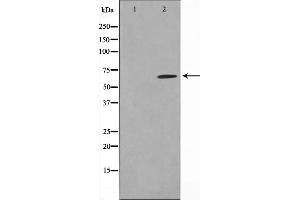 Western blot analysis on NIH-3T3 cell lysate using CCDC99 Antibody,The lane on the left is treated with the antigen-specific peptide.