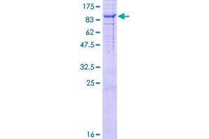 Image no. 1 for FERM Domain Containing 5 (FRMD5) (AA 1-570) protein (GST tag) (ABIN1354432) (FRMD5 Protein (AA 1-570) (GST tag))