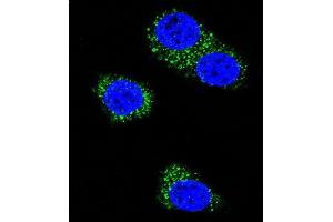 Confocal immunofluorescent analysis of Presenilin 1 (PSEN1) Antibody (C-term) (ABIN390169 and ABIN2840665) with MDA-M cell followed by Alexa Fluor 488-conjugated goat anti-rabbit lgG (green). (Presenilin 1 抗体  (C-Term))