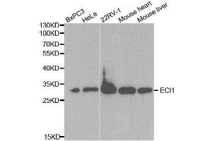 Western blot analysis of extracts of various cell lines, using ECI1 antibody. (DCI 抗体  (AA 63-302))