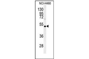 Western blot analysis of DGAT2 Antibody (N-term) in NCI-H460 cell line lysates (35ug/lane). (DGAT2 抗体  (N-Term))