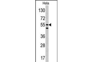 Western blot analysis of CA9 antibody (Center) (ABIN390041 and ABIN2840124) in Hela cell line lysates (35 μg/lane). (CA9 抗体  (AA 113-143))